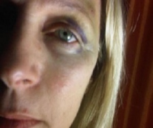 Foto tuiteada por la agredida.