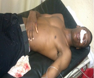 José Alejandro, uno de los bomberos heridos 