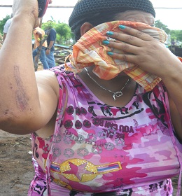 Victoria Coronado muestra laceraciones en su brazo derecho que sufrió al correr a las bombas.