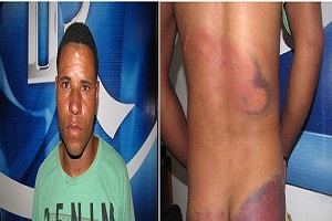 MOTOCONCHISTA GOLPEADO PP