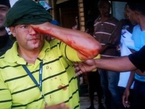 José Cruz, camarágrafo de Telenoticias